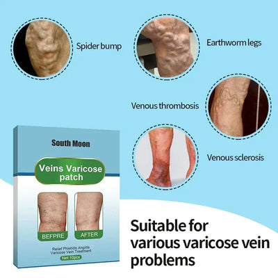 Varicose Veins Relief Patch Foot Care Vasculitis Phlebitis Treatment Cream Spider Leg Varicosity Angiitis Legs Dilated Medicine