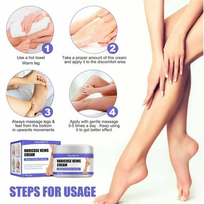 Varicose Vein Treatments Cream Effective Relieve Legs Dilated Vasculitis Phlebitis Natural Formula Ointment for Varicose Veins