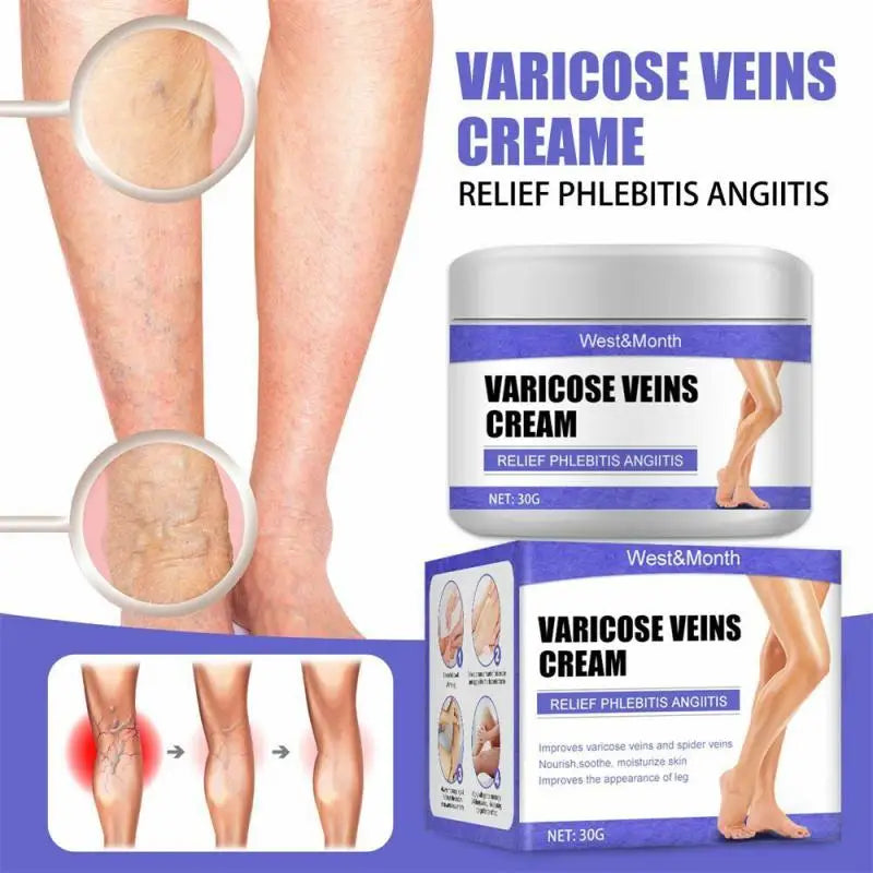 Treatment Cream for Dilated Vasculitis and Phlebitis - Effective Relief for Legs